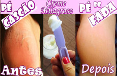 creme-caseiro-para-pes-rachados-12-10