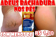 como-acabar-com-as-rachaduras-dos-pes-06-11