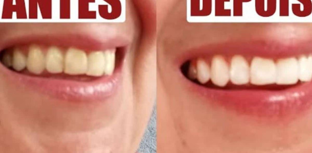 dica-para-clarear-os-dentes-1104